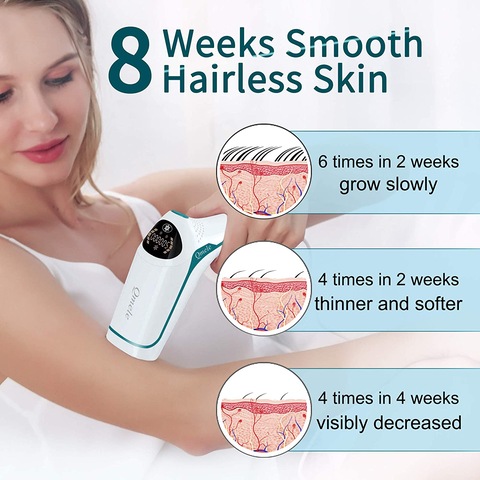 Hair Removal for Women Qmele 500000