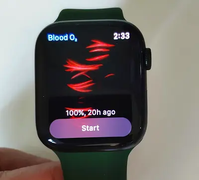 Apple - Watch Series 7 GPS + Cellular 45mm (Fixed Price)