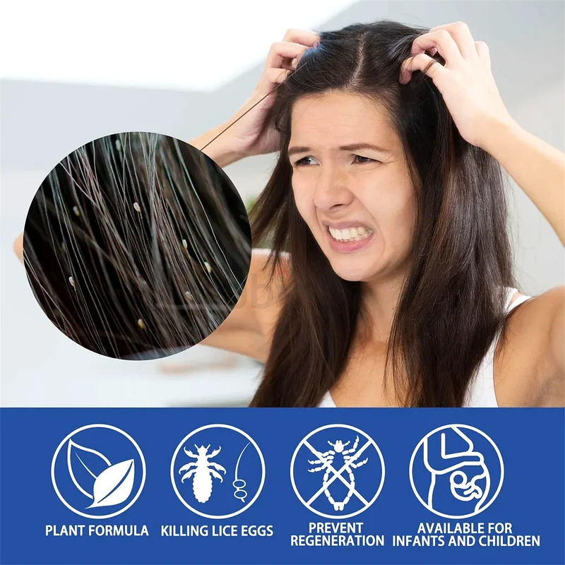 Scabies Repel Removal Lice Eggs Personal Care Lice Kill 30m63437992096770110