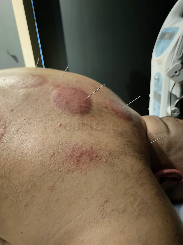 العلاج الطبيعي63219832288514112