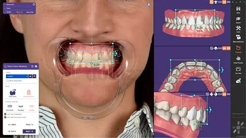 DENTAL DESIGN SOFTWARE FOR SALE