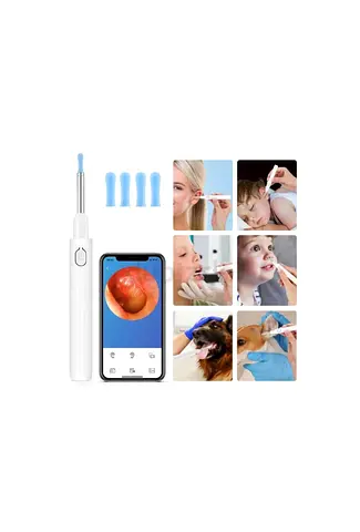 Smart Ear Wax Removal Tool with Camera