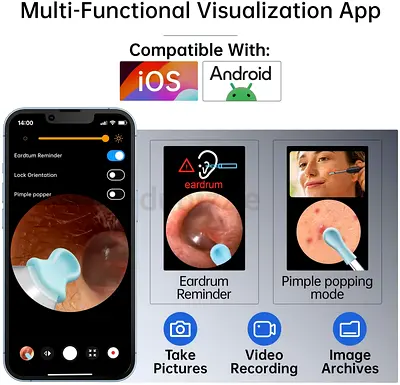 WiFi Otoscope Ear Camera - iOS  Android Compatible