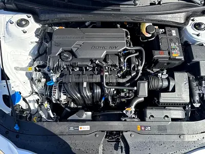 Hyundai Elantra SEL Sport, миниатюра 2