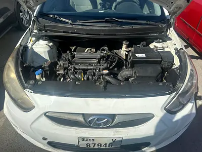 2016 Hyundai ACCENT 照片 2