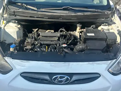 2016 Hyundai ACCENT 照片 4