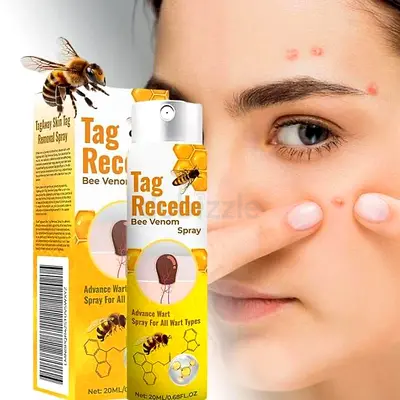 Mole Remover