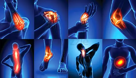 Physiotherapy Rehab Program